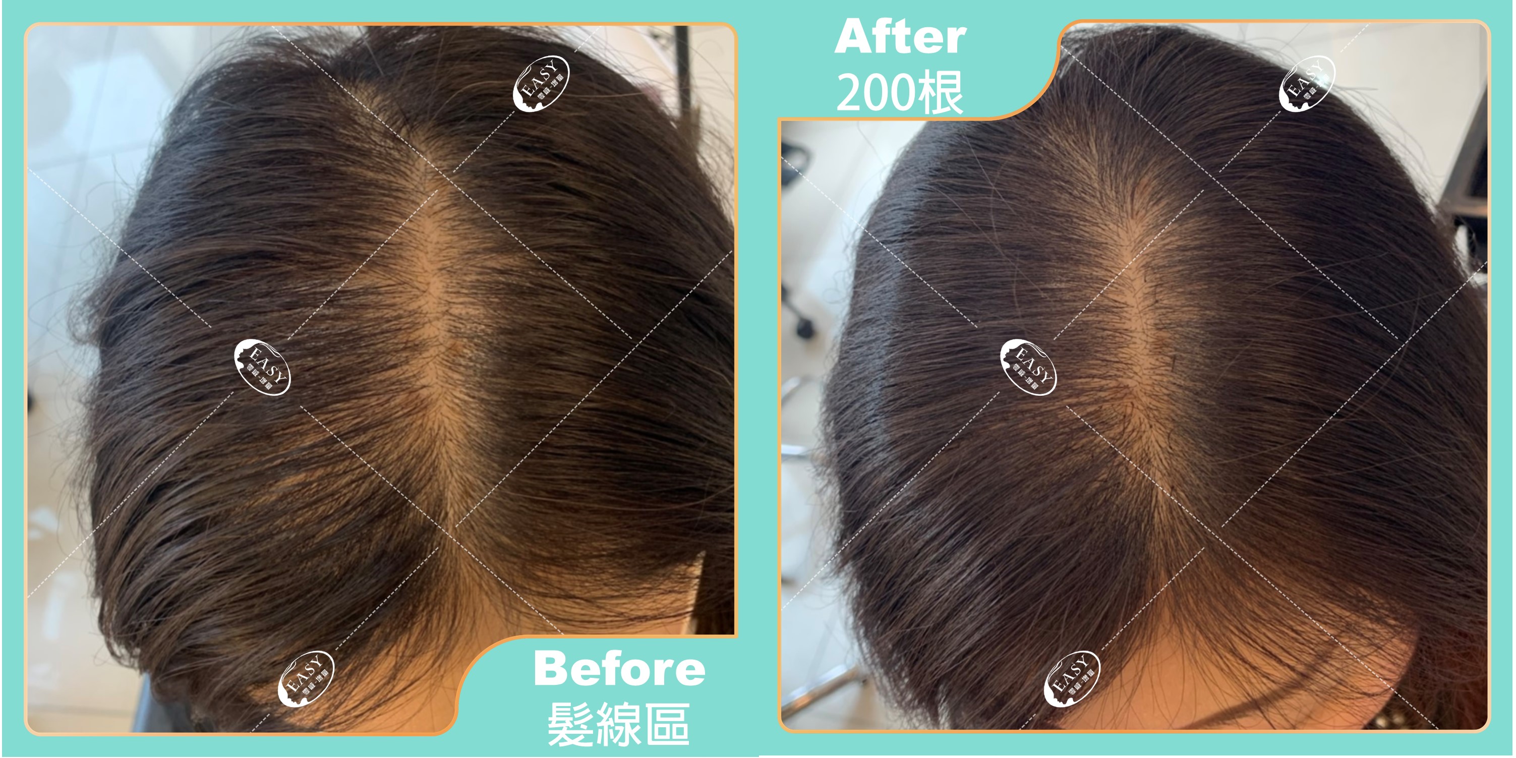分髮線體驗增加膨度讓頭頂不在扁塌。